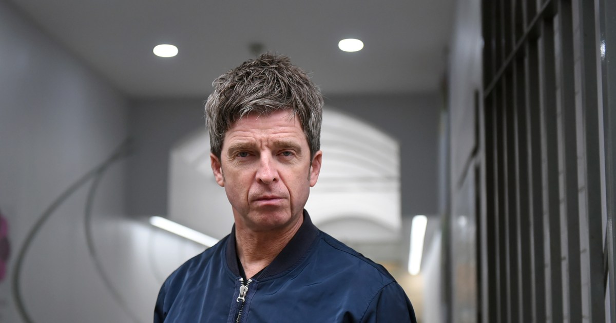 Noel Gallagher needs medical attention after being headbutted during soccer celebration.jpg